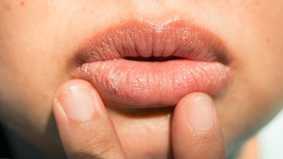 7-homemade-remedies-for-dry-and-chapped-lips-7-homemade-remedies-for