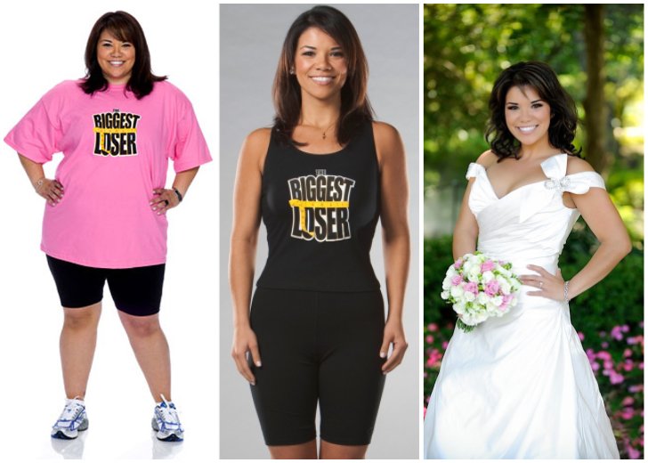 "The Biggest Loser" Winners Then And Now - Tummy Tuck Hipo