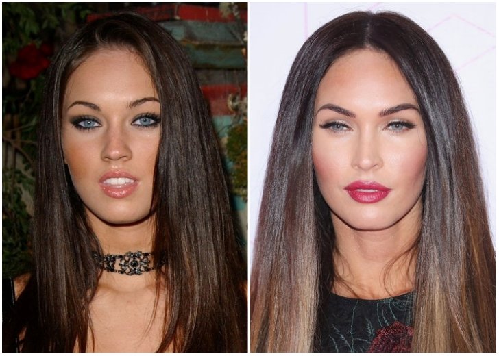 Celebrity Plastic Surgery: Before and After Pictures - Page 5 of 59 ...