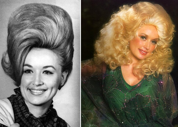 Iconic Celebrities You D Be Surprised Are Wearing Wigs All The Time Page 37 Of 49 Tummy Tuck